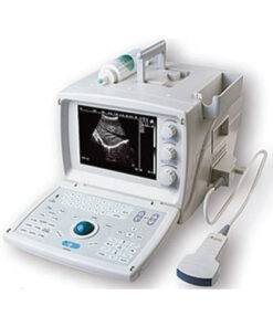 Portable Ultrasound – Black & White (9.7″ LCD)