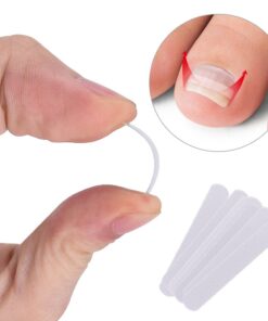 Ingrown toenail corrector strips