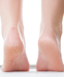 Heel Peel Course - One on One