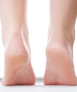 i-Spa Heel Peel Online Course